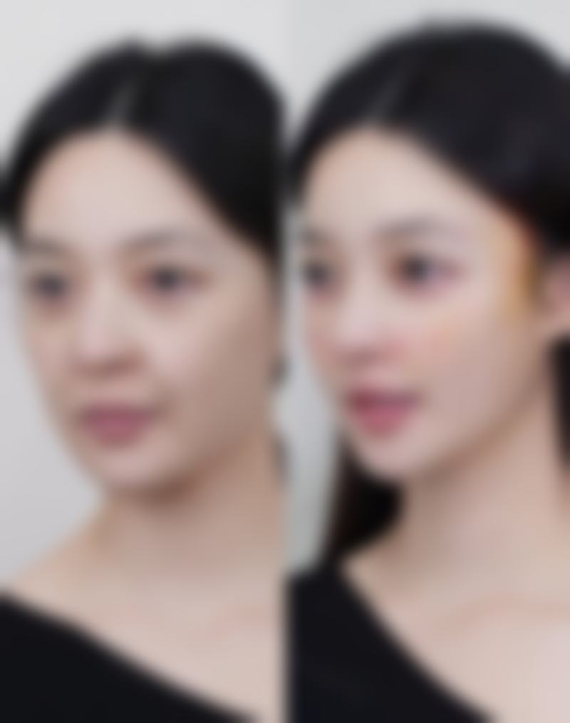 潮州市保丽圣美医疗美容收费标准参考