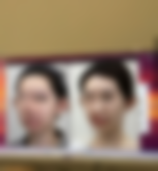 跳绳与消除眼袋的关系
