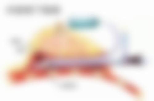 如何延长自体耳软骨隆鼻的维持时间