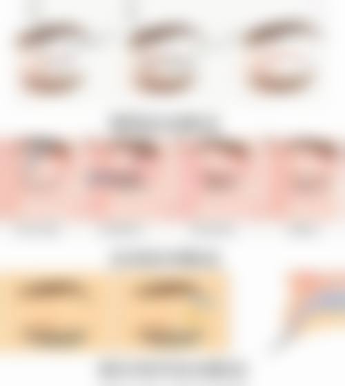 加速修复的方法