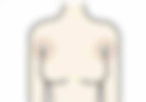 邵阳美莱医疗美容诊所郑祥奎医生口碑评价如何?