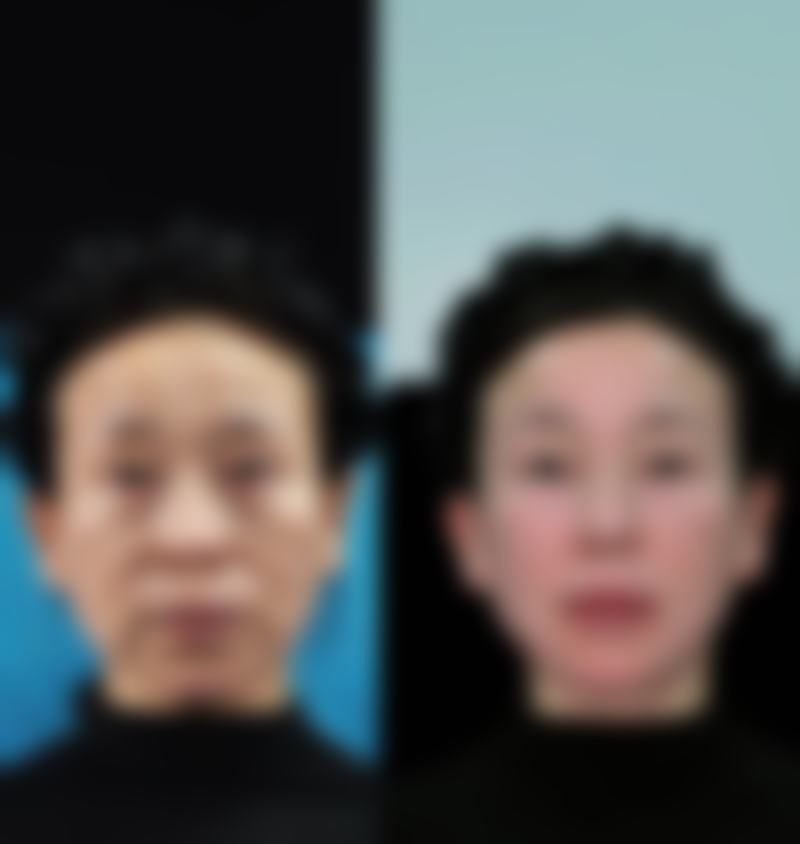 七、烟台韩美医疗美容门诊部价格表:(仅供参考)