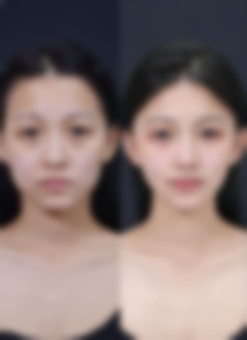 莲姿娜半恒久纹眉皮肤管理(福州店)医生简介