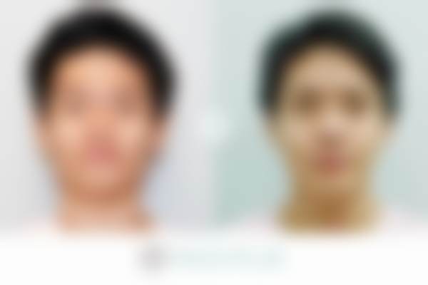 韩国faceplus整形外科电话号码及预约方法