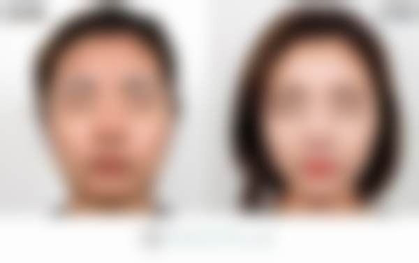 总结——韩国faceplus整形外科怎么样？