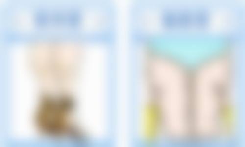 总结——上海凯渥医疗美容门诊部陈立杰医生怎么样?