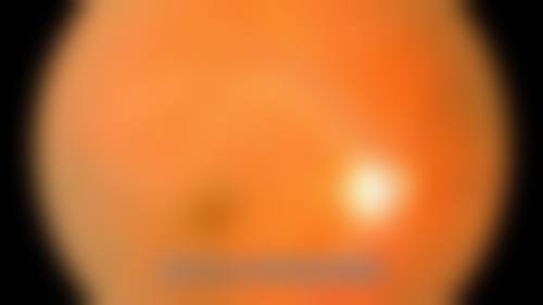 七、宜兴眼科医院价格表：（仅供参考）