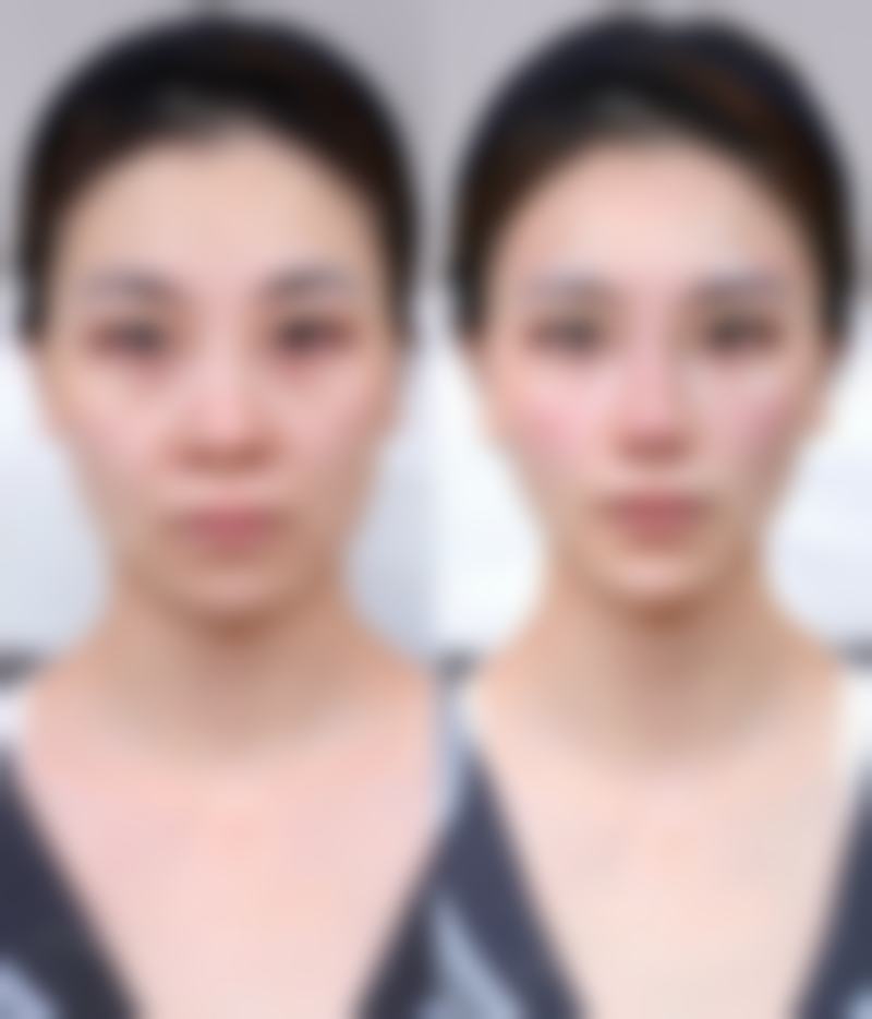 景洪恩夏医疗美容诊所医院技术好不好?