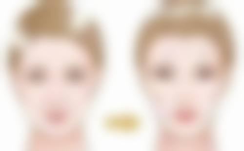 腰腹吸脂塑身的手术方法
