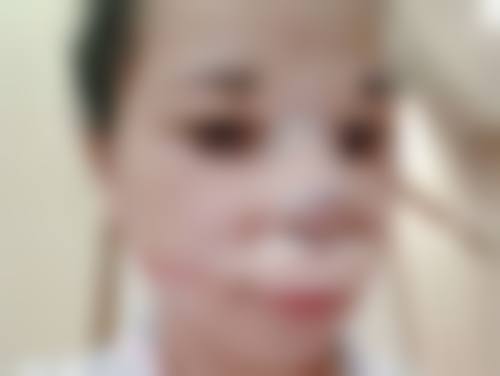 韩国345整形外科收费标准参考