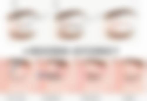 腰腹吸脂塑身的修复时间