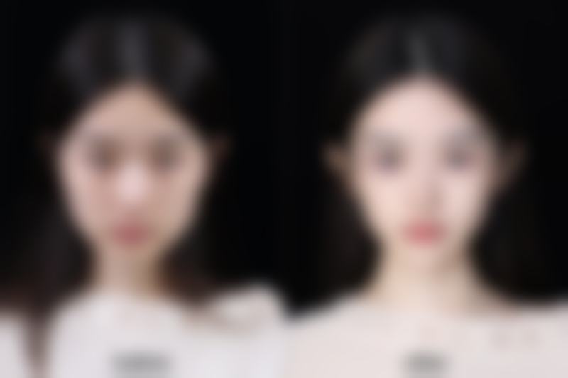 总结——阜阳佳美医学皮肤美容诊所怎么样？