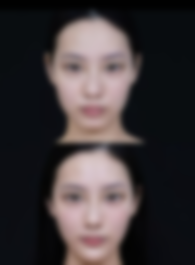 按摩眼袋有什么注意事项