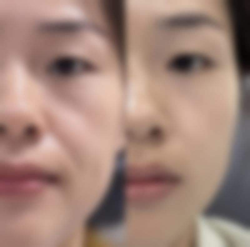 廊坊幸福医院整形科收费标准参考