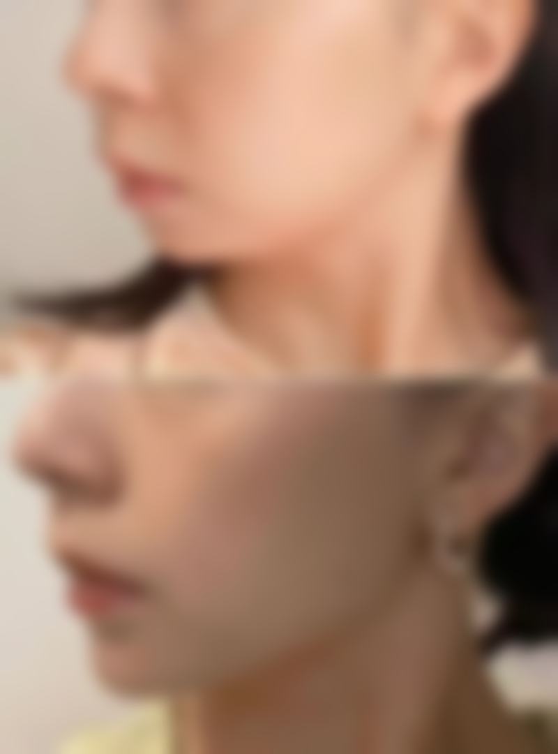 多次修复对修复时间的影响