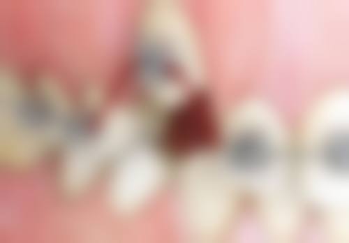 七、漳州芗城康桥口腔门诊部价格表:(仅供参考)