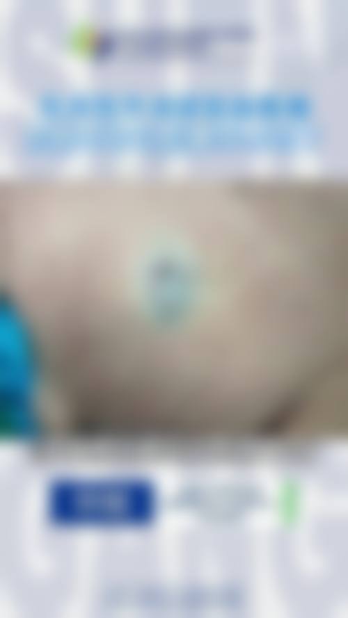 优惠活动详情:面部精细化雕刻原价12800元,优惠价8800元