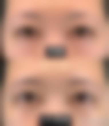 临床实例分享