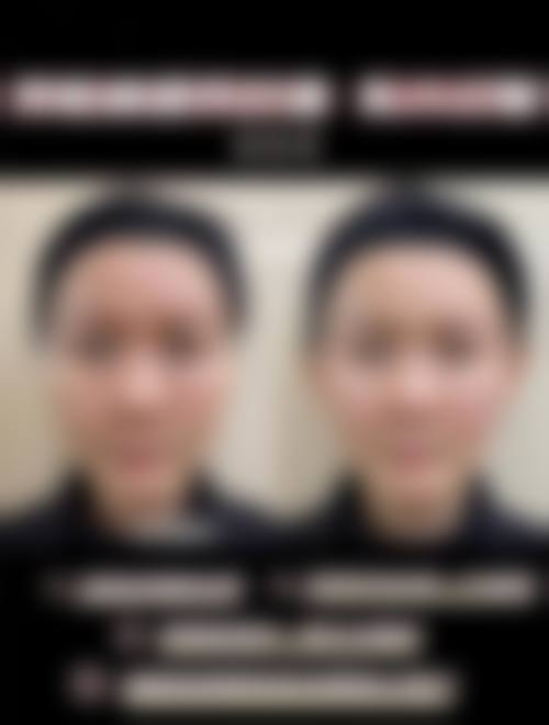 预约优惠活动