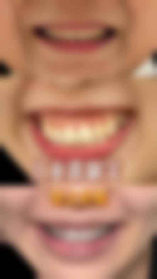 擅长项目详解