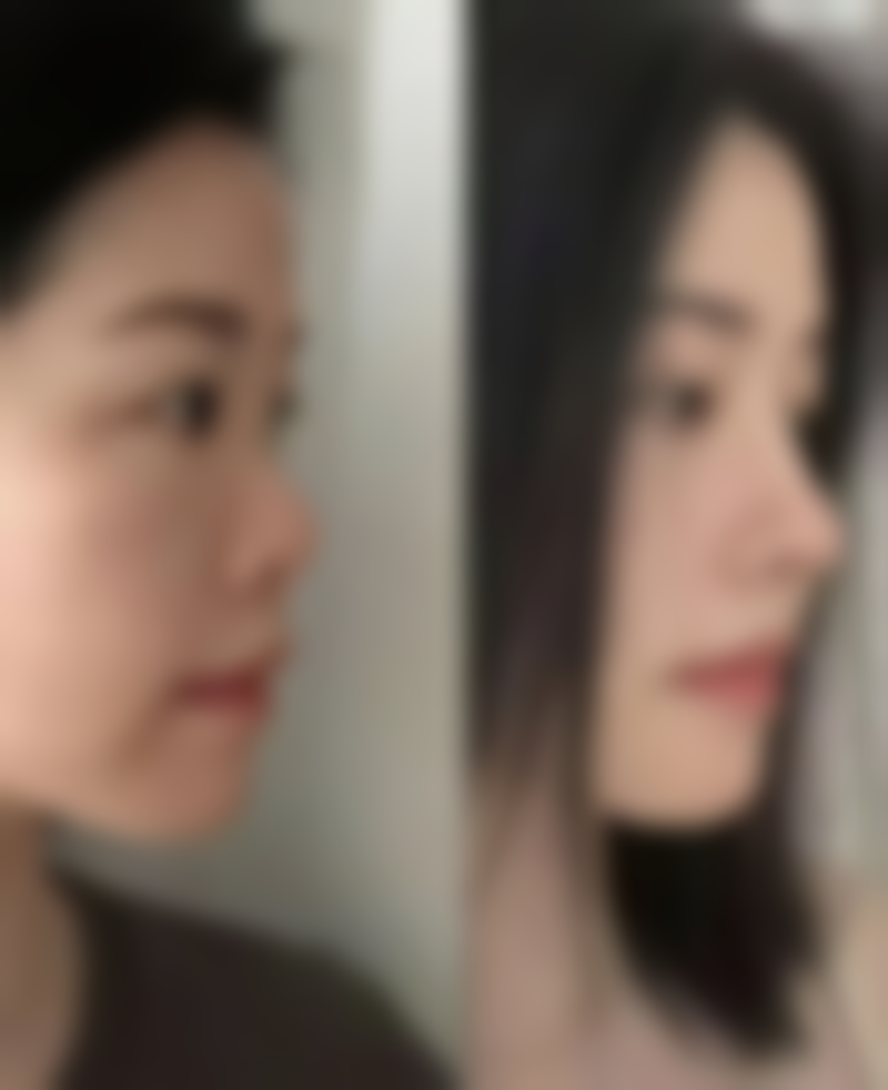 宁德韩美整形美容医院收费标准参考