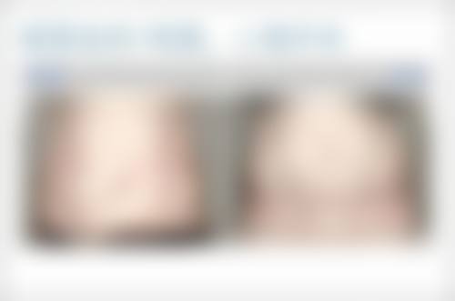 韩国拉菲安整形外科金秀芝医生技术好不好?