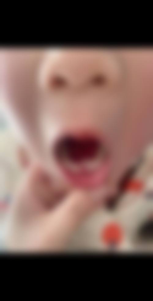 四、广州维密欧贝丽口腔门诊开展的项目以及特色项目