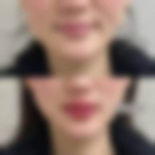 四、东莞华美女子国内外整形医学美容中 心开展的项目以及特色项目