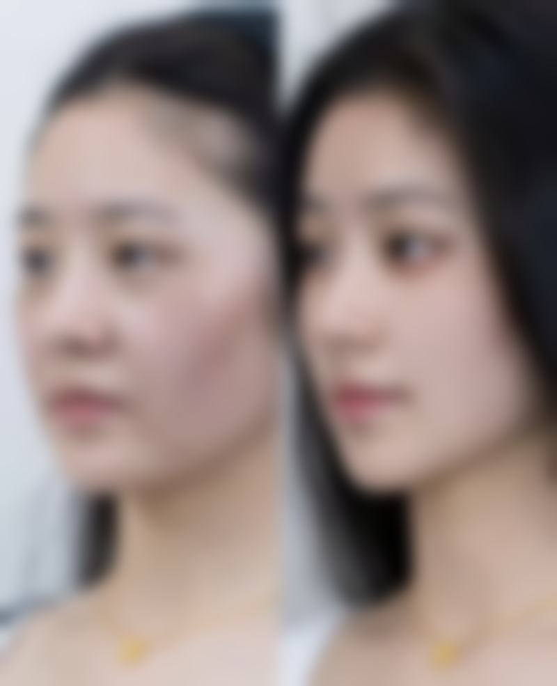 重庆渝北珂琳雅医疗美容门诊部党青医生挂号预约攻略