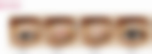 中山爱思特美容医院陈洪艳医生技术好不好?