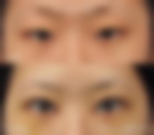 优惠活动详情:美丽无忧的体验