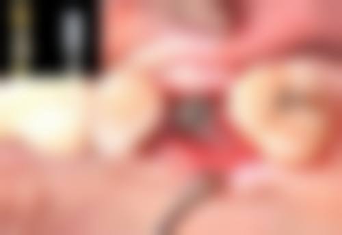 特色科室与项目:覆盖全年龄段口腔需求
