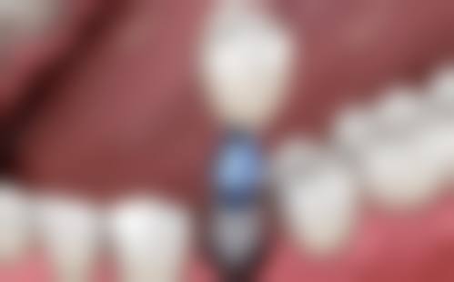 特色诊疗项目:覆盖全年龄段口腔需求
