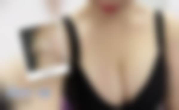 总结——北京禾美嘉医疗美容门诊部李梦莹医生怎么样?