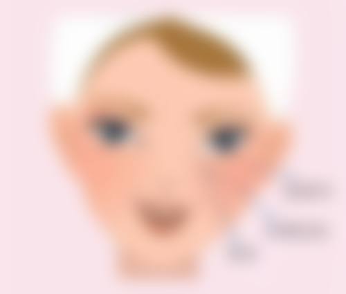 延长假体寿命的方法