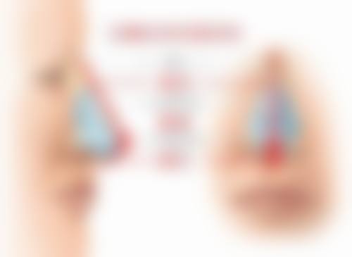 疤痕疙瘩和疤痕增生的发病原因区别
