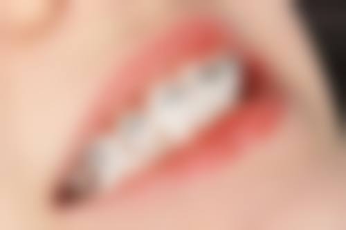 七、诸暨真诚口腔价格表:(仅供参考)