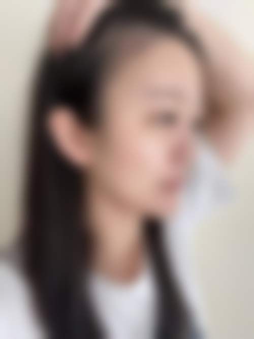 扬州俏华美医美科普:韩国瘦脸适合哪些人呢?