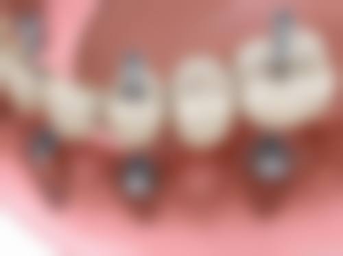 八、山西吕梁孝义爱牙口腔用户真实实例