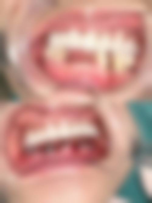 预约优惠活动