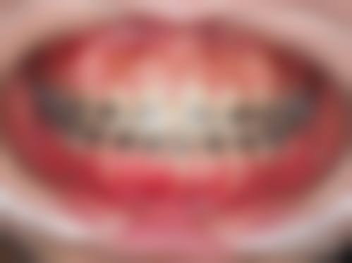 诊疗特色总结 黄轶牙齿种植