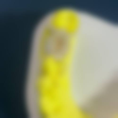 临床实例分享