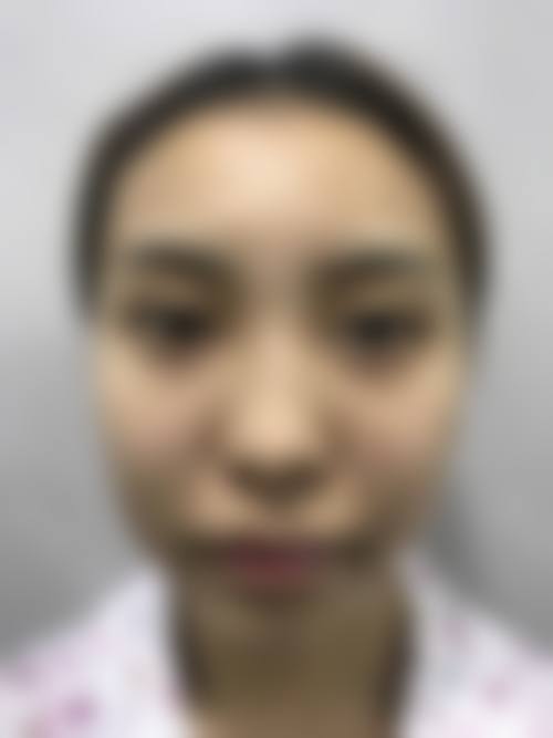 常见疑问解答