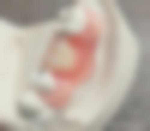 临床实例分享 黄轶苏州美莱口腔