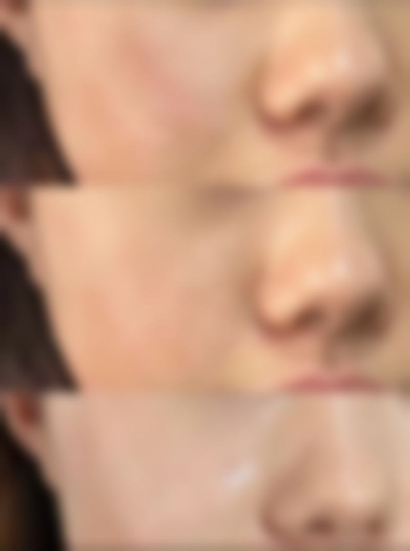 中山尼姬医疗整形美容门诊部收费标准参考