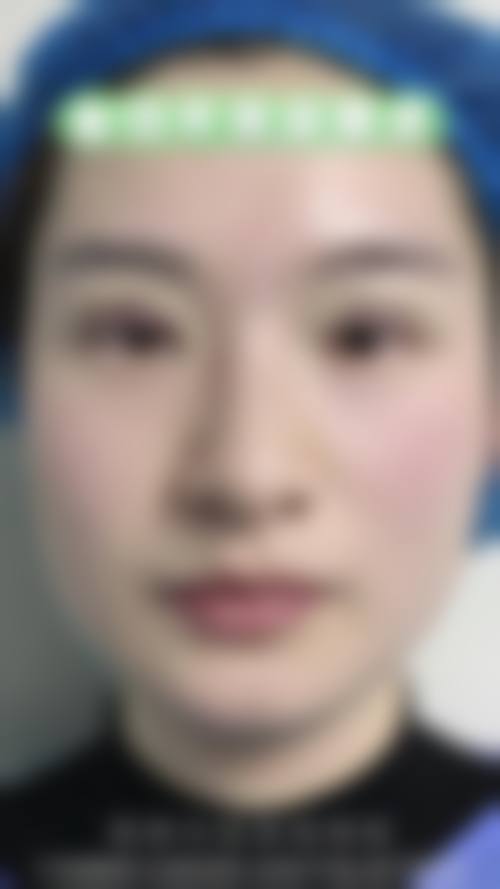 FAQ:求美者更关心的两个问题