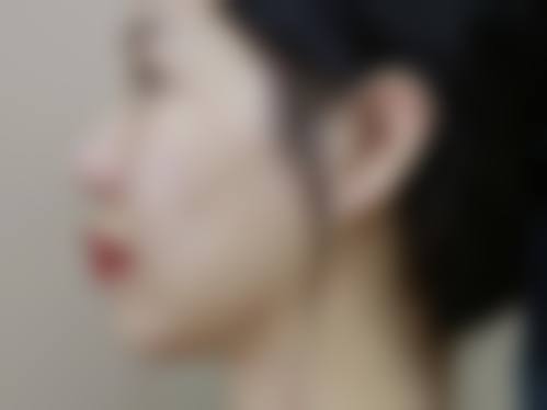 擅长项目详解