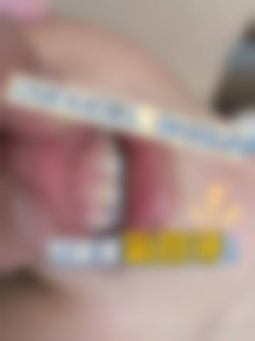 优惠活动详情:高性价比看牙正当时
