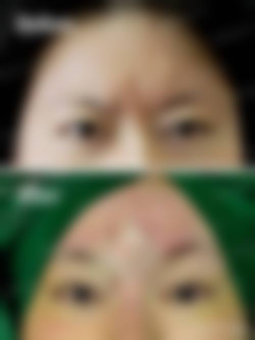 设备环境与安心保护:科技助力医美