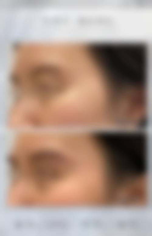 优惠活动与预约方式:限时补贴助力变得更美